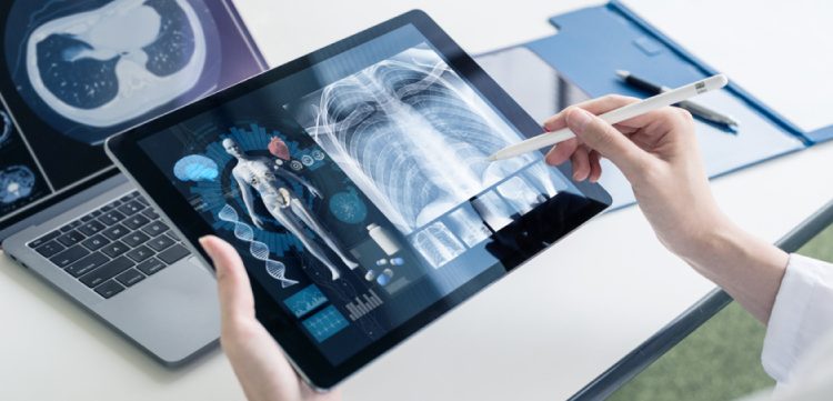 Transforming Healthcare with IoT