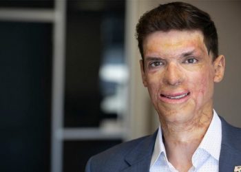 Wounded US Army vet Sam Brown targets vulnerable Nevada Democrat with fresh Senate bid: ‘Out of touch’