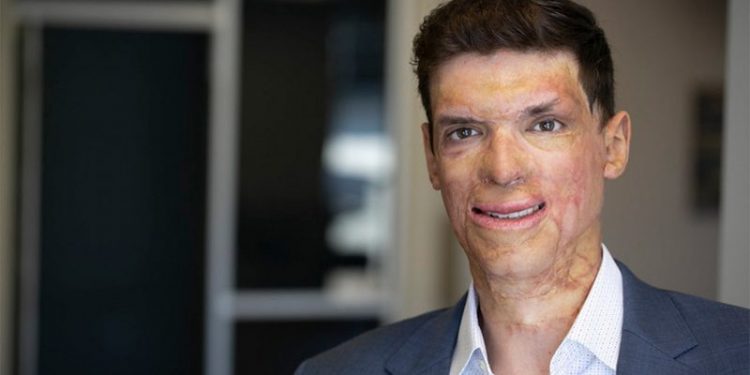 Wounded US Army vet Sam Brown targets vulnerable Nevada Democrat with fresh Senate bid: ‘Out of touch’